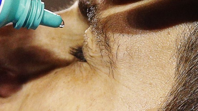 Пациентите с глаукома притеснени &ndash; липсва основно лекарство