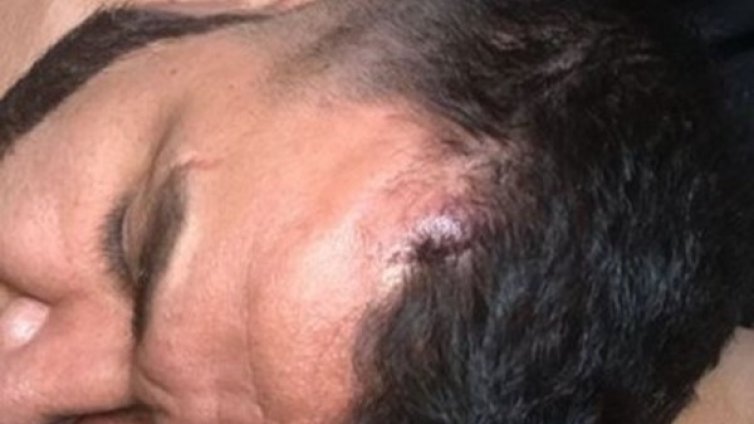 С разбита глава Азис пял пред три хиляди души