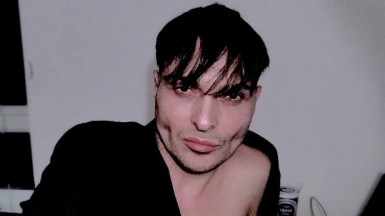 Иво Димчев: ХИВ не се прихваща от въздуха, болестта не е срамна