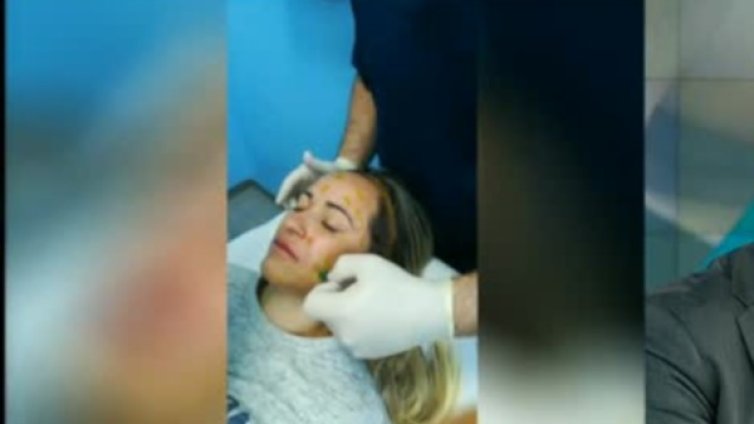 Да си вечно млад: Учени откриха как да не старее кожата