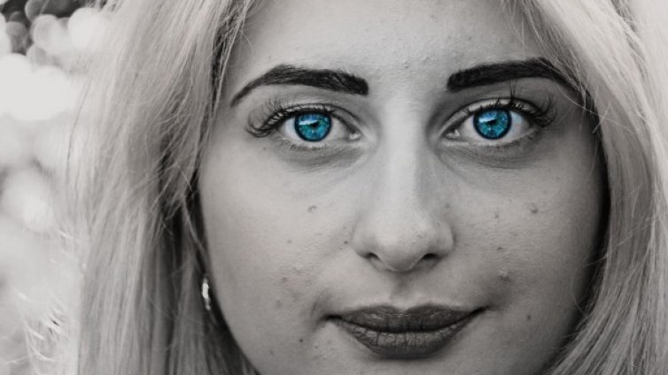 При акне - елиминирайте някои вредни навици 