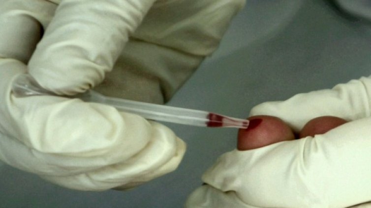 Нов случай на ХИВ, пациентът от община Горна Оряховица