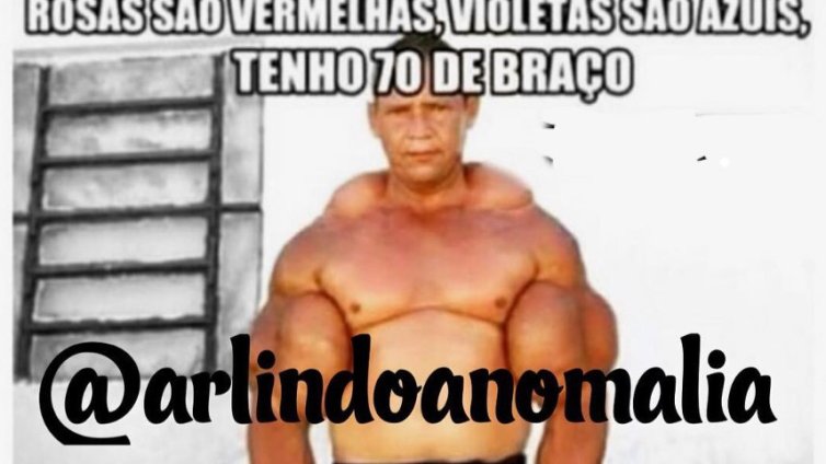 Почина "бразилският Попай", инжектирал минерално масло и алкохол в бицепсите си