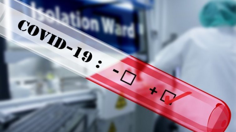 В частна лаборатория в София: 1000 души са си направили тест за COVID-19