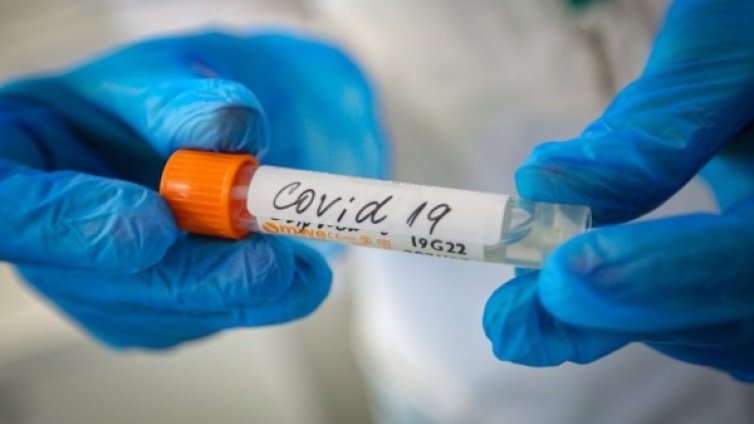 Около 60-70% от хората ще изкарат COVID-19  на крак