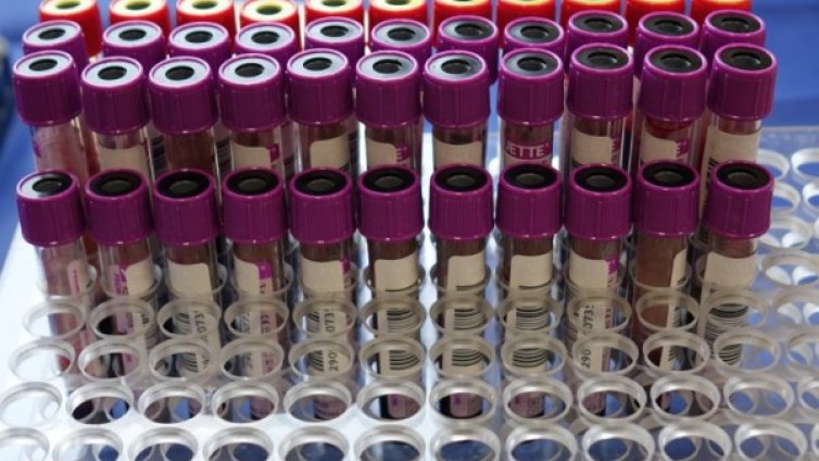 Заразеният от Видинско с коронавирус нямал контакти с болни