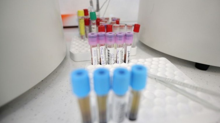 Първи пациент с вируса е приет в болницата в Монтана
