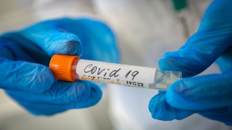 Поредна жертва: COVID-19 отне живота на 44-годишна жена от Сливен 