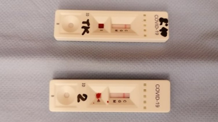 713 са вече случаите на COVID-19 у нас, 27 от тях са деца