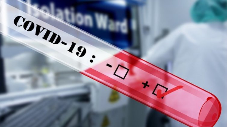 34 души круизен кораб в Япония с COVID-19 