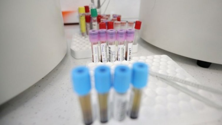 Няма заразени с коронавирус в Спешна помощ в Пловдив