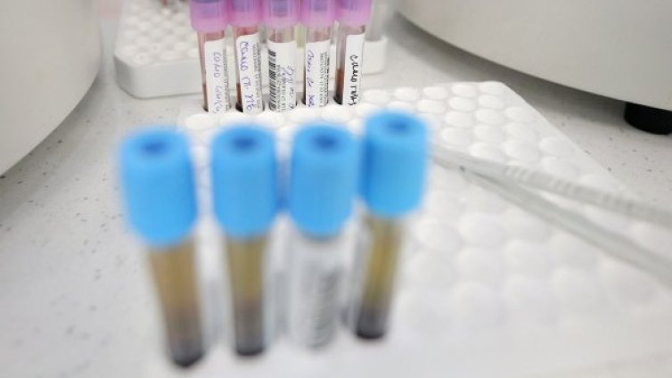 Пациентите с коронавирус в Русия вече са над 110 000