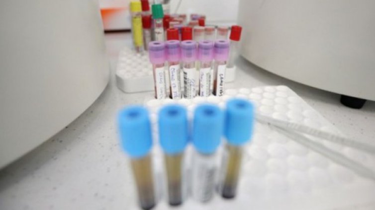 Позитивният PCR тест не означава, че има заразен с вирус