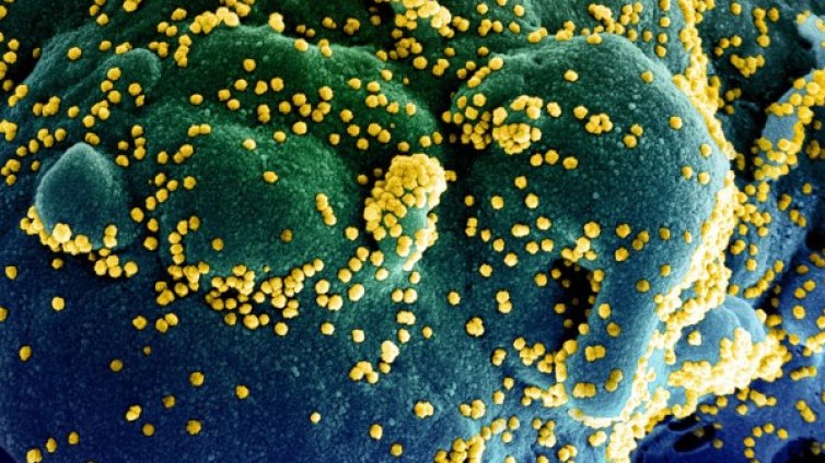 За първи път в света откриха коронавирус в корема на пациент