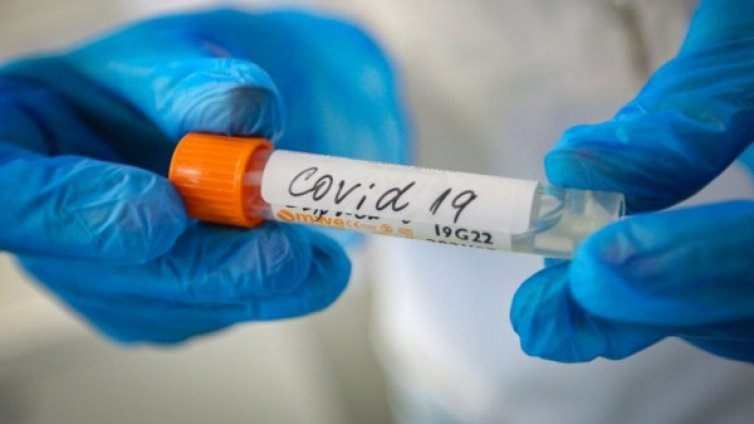 Коронавирусът нямало да изчезне през лятото