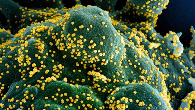 Най-голямата загадка: Гените ли са решаващи при коронавируса?