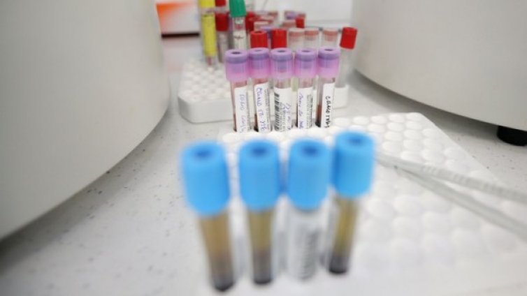 Черен рекорд в Русия, 153 починали с коронавирус за ден