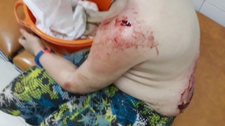 50-килограмово Кане Корсо нахапа жестоко 10-годишно дете 