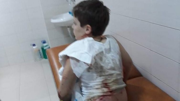 Майката на нахапаното от куче дете: Само с извинение не става 