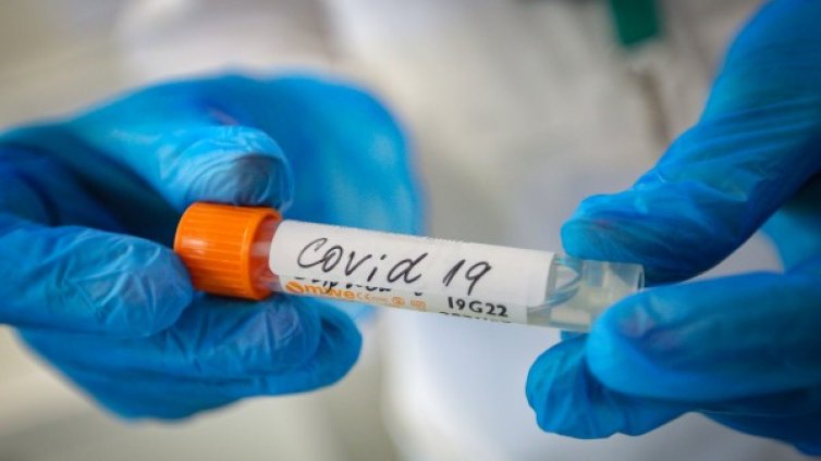 Коронавирусът взел над 395 хил. жертви по света 