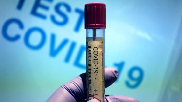 САЩ с милиони дози от ваксина срещу COVID, а ЕС?