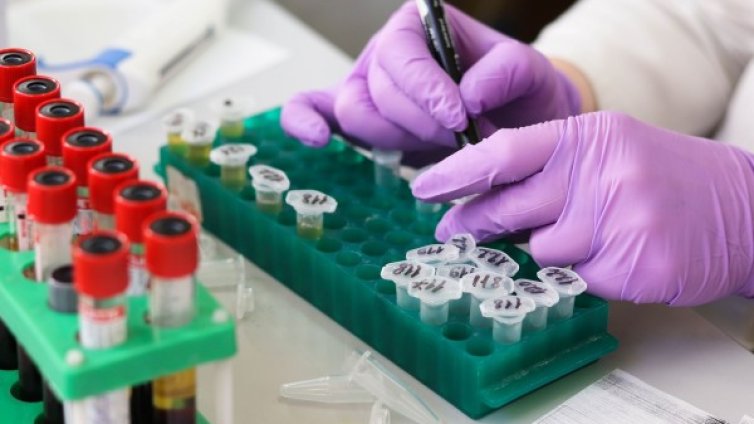 20 медици от частната болница в Сливен са заразени с COVID-19 