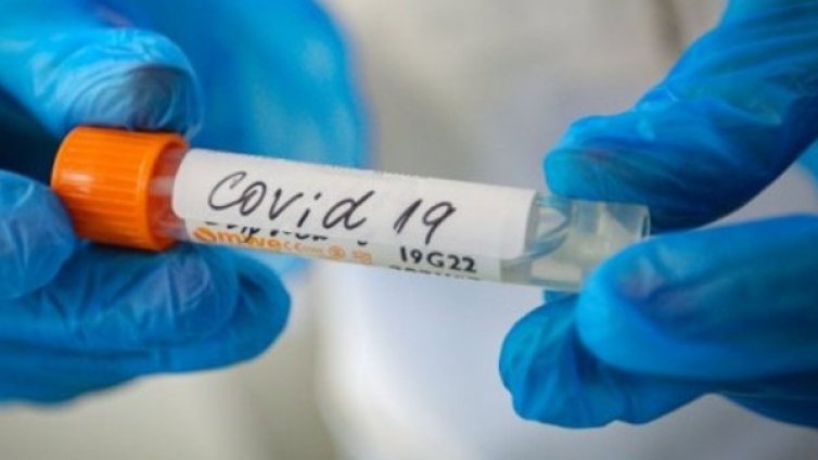 Бразилия - на второ място по брой жертви от COVID-19 след САЩ