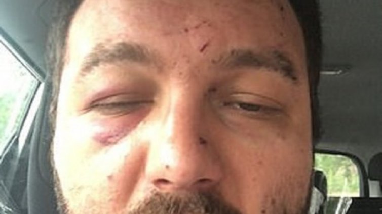 Британци пребиха зверски българин в Норич, возил ги в такси
