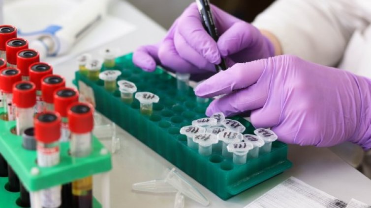 Всички PCR тестове за COVID-19 в Горна Оряховица &ndash; отрицателни 