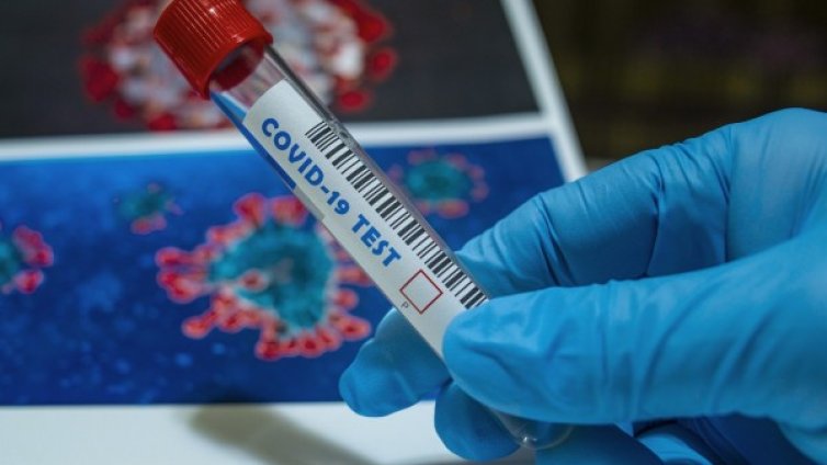 Абитуриентът с коронавирус имал само главоболие преди бала