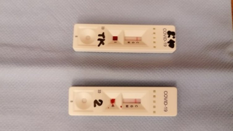 232 нови случая на коронавирус, с двама по-малко от вчера 