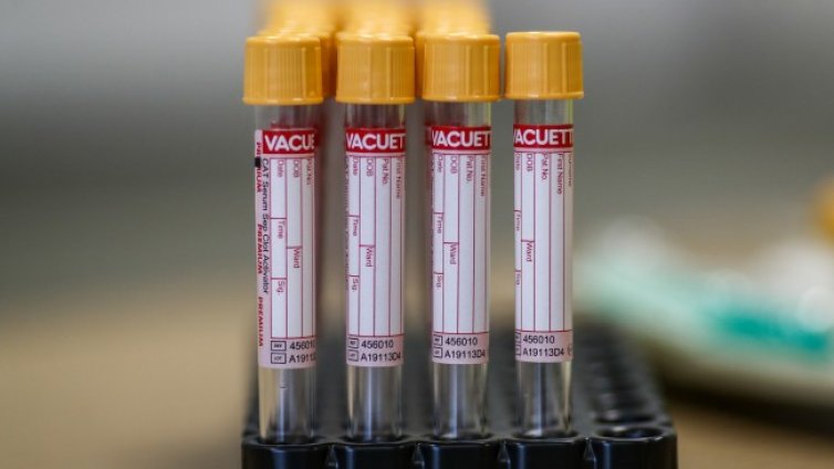 Най-лошият вариант &ndash; в края на септември 25 000 с коронавирус