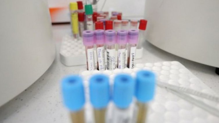 11 са новозаразените с COVID-19 в област Хасково