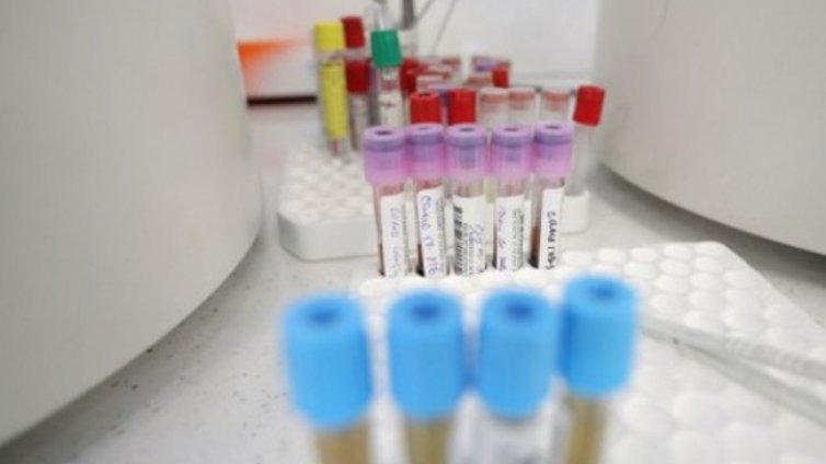 Няма данни коронавирусът да протича по-тежко, смята вирусолог