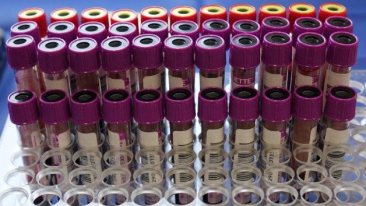 Петима от персонала в дома за стари хора в Баня са с коронавирус