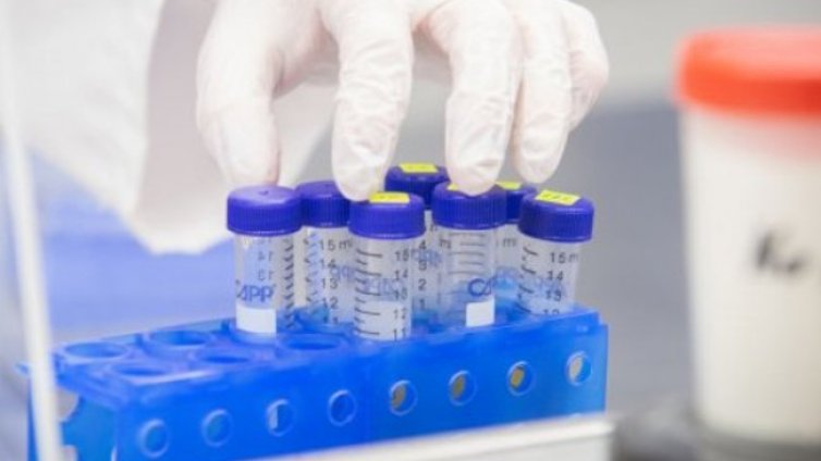 Дълги опашки пред лабораториите за PCR-тест