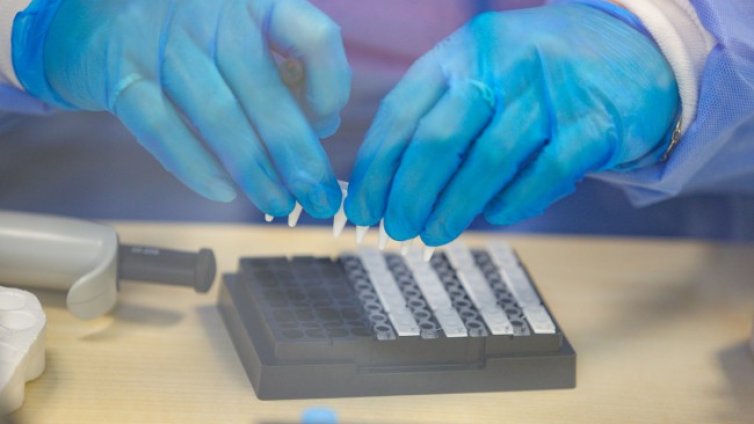 Един от четири смъртни случая във Франция заради вируса