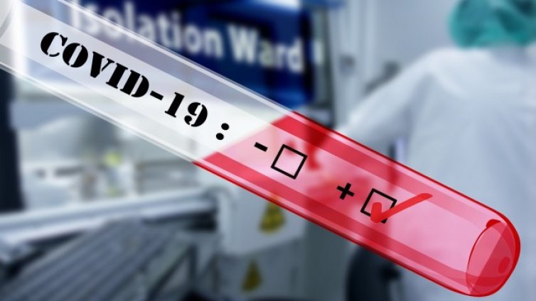184 души медицински персонал в област Сливен са с COVID-19