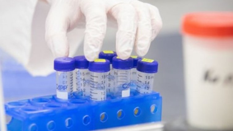 Кардиолог: Рядко човек би отключил заболяване след вируса