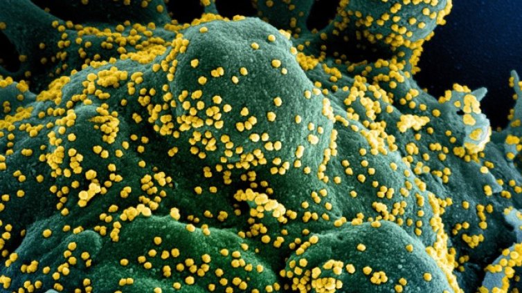 Сръбски учен: Първата жертва на COVID-19 в Европа е в Сърбия