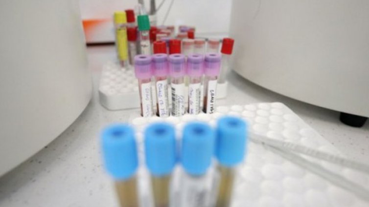 За денонощието: 4,5% положителни за коронавирус, 627 излекувани, 24 починали