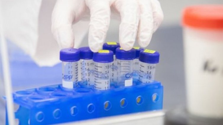 Вирусолог: Овладяването на вируса не става за година-две!