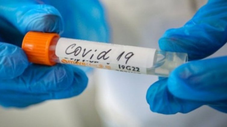 Девет от починалите от коронавирус - без придружаващи заболявания