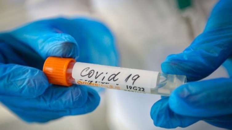 Близо 106 милиона са заразените с коронавирус по света