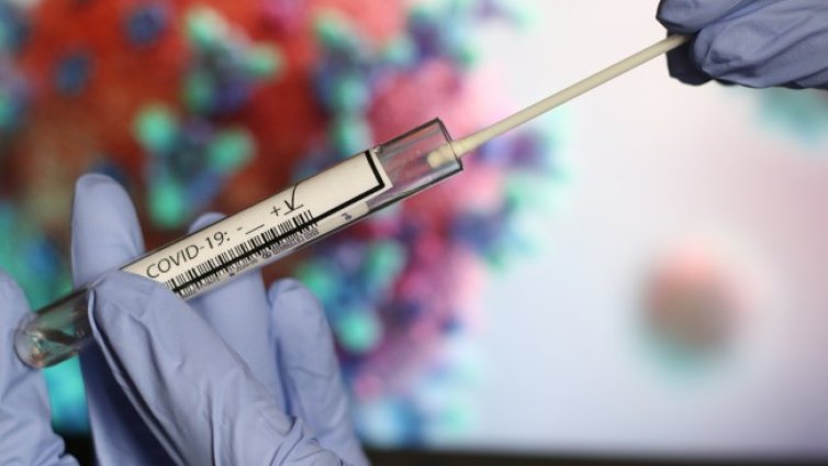 Ръст на заразените с COVID-19 в Бургаско