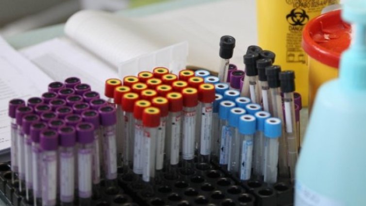 39-годишен без болести е сред починалите с коронавирус