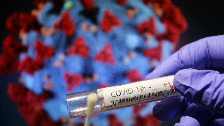 Всеки трети след Covid-19 има неврологични проблеми