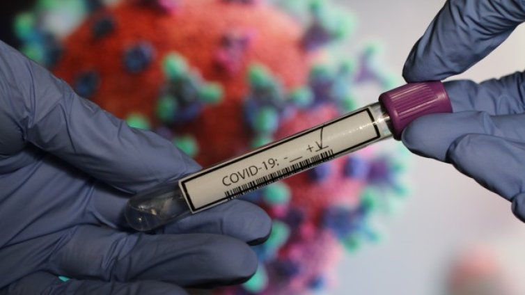 Нов метод: За 40 минути хващат мутации на COVID-19