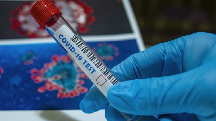 Русия с нов антирекорд: 815 починали с COVID-19 за ден