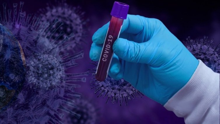 Къде в Европа плащат най-скъпи PCR тестове?